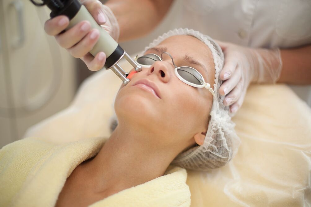 Laser skin rejuvenation