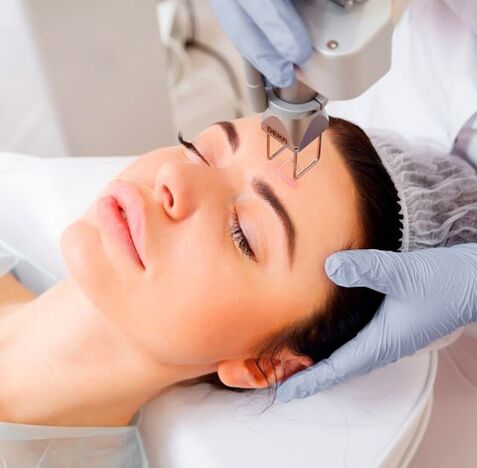 Laser facial rejuvenation