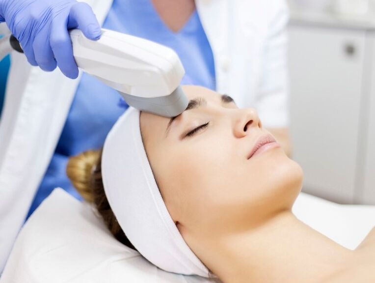 Laser skin rejuvenation
