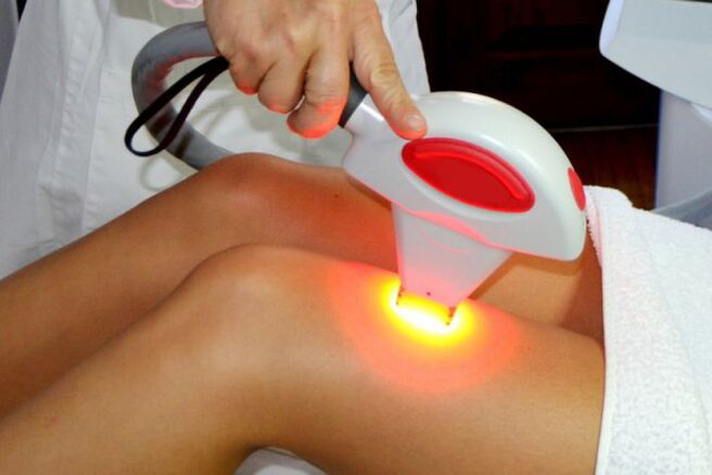 Laser hair removal