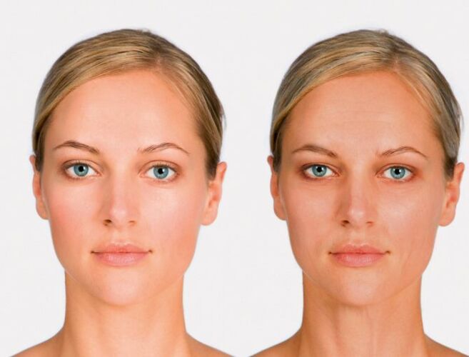 face after rejuvenation